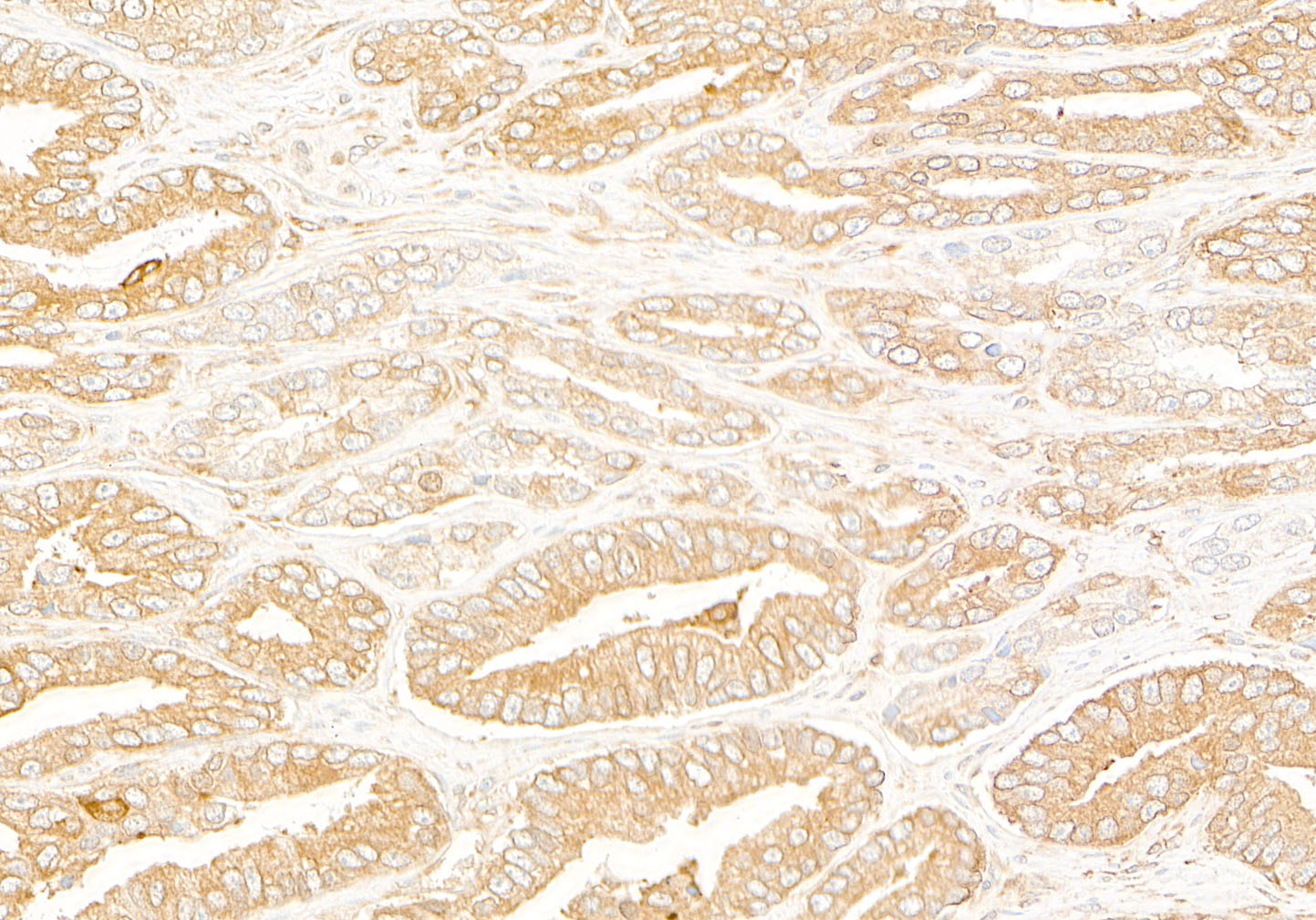 Detection of human RPS3 by immunohistochemistry.