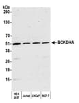 Detection of human BCKDHA by western blot.