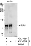 Detection of human TAB2 by western blot of immunoprecipitates.