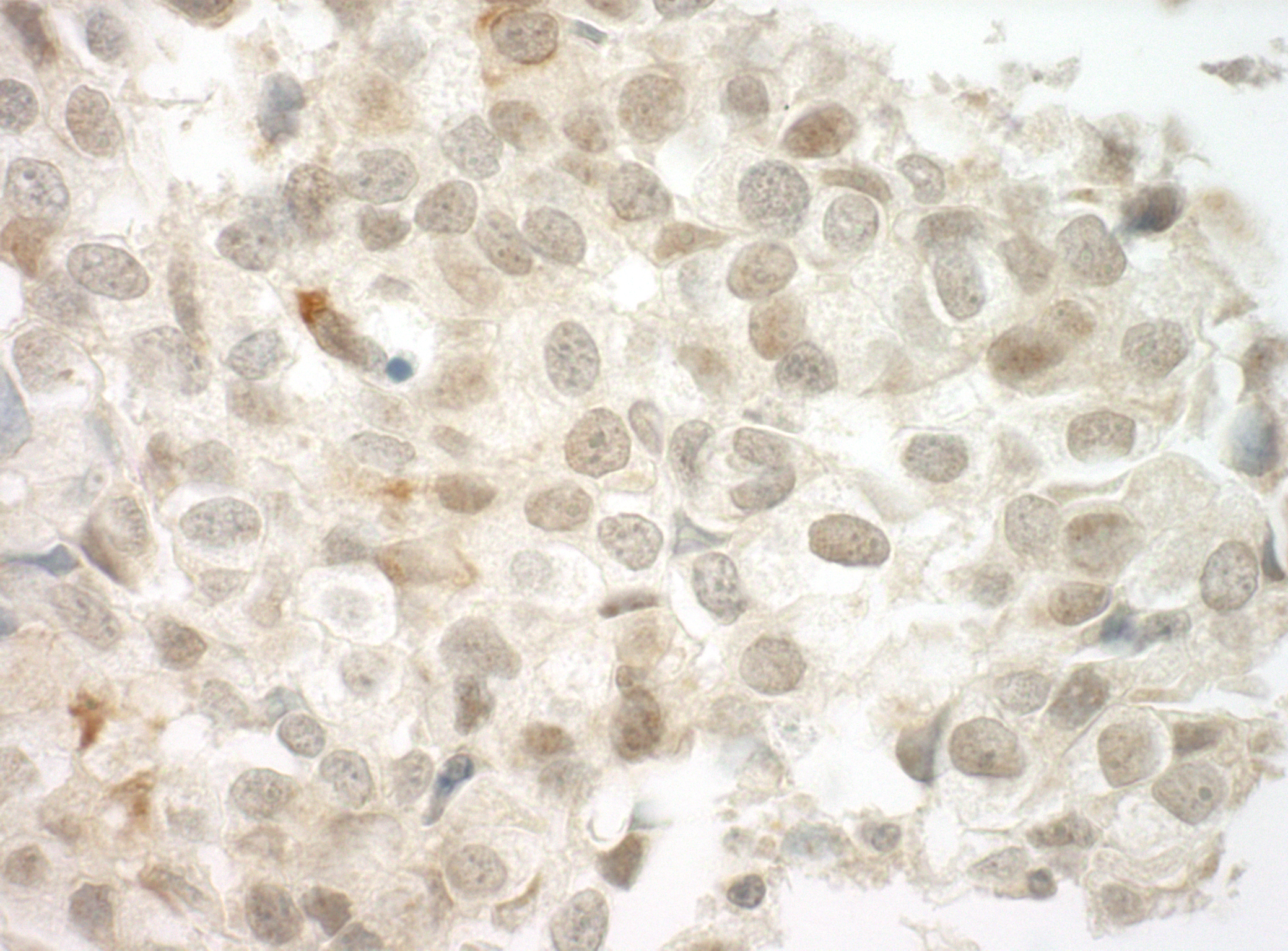 Rabbit anti-PRCC IHC Antibody