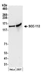 Detection of human SCC-112 by western blot.