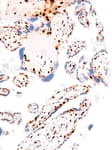 Detection of human p57Kip2 by immunohistochemistry.