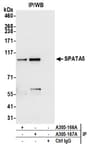 Detection of human SPATA5 by western blot of immunoprecipitates.