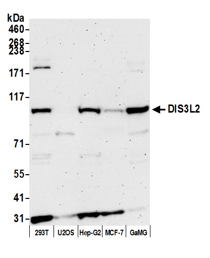 Rabbit anti-DIS3L2 Antibody