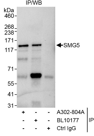 Detection of human SMG5 by western blot of immunoprecipitates.