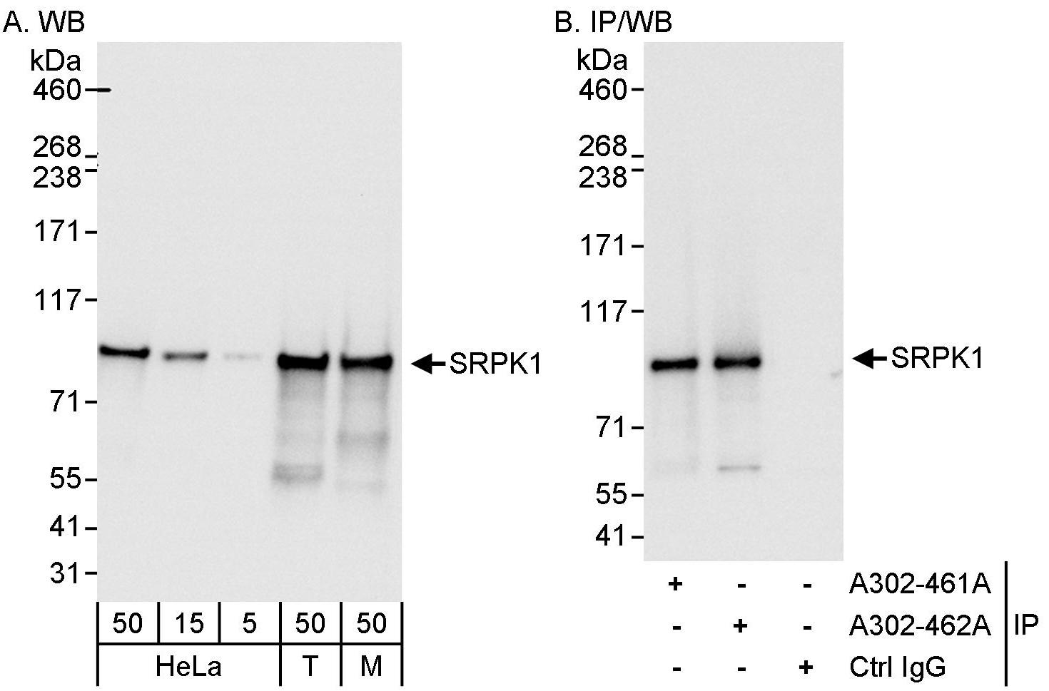 Detection of human and mouse SRPK1 by western blot (h &amp; m) and immunoprecipitation (h).