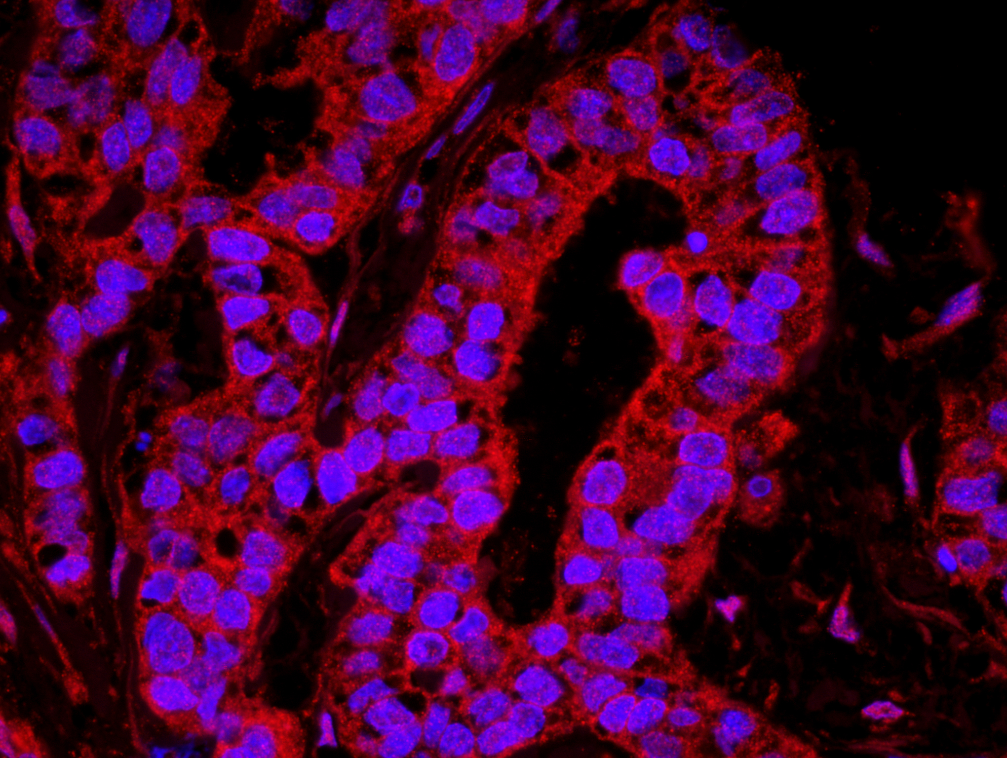 Rabbit anti-YAP1 IHC Antibody