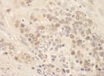 Detection of mouse SIP1 by immunohistochemistry.