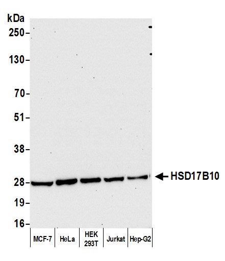 Rabbit anti-HSD17B10 Antibody, Affinity Purified