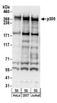 Detection of human p300 by western blot.