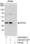 Detection of human RCAS1 by western blot of immunoprecipitates.