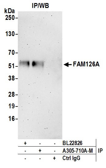 Rabbit anti-FAM126A Antibody
