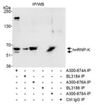 Detection of human hnRNP-K by western blot of immunoprecipitates.