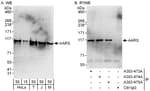 Detection of human and mouse AARS by western blot (h and m) and immunoprecipitation (h).