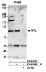Detection of human NVL by western blot of immunoprecipitates.