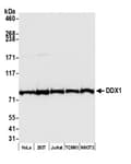 Detection of human and mouse DDX1 by western blot.