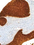 Detection of human p16INK4a by immunohistochemistry.