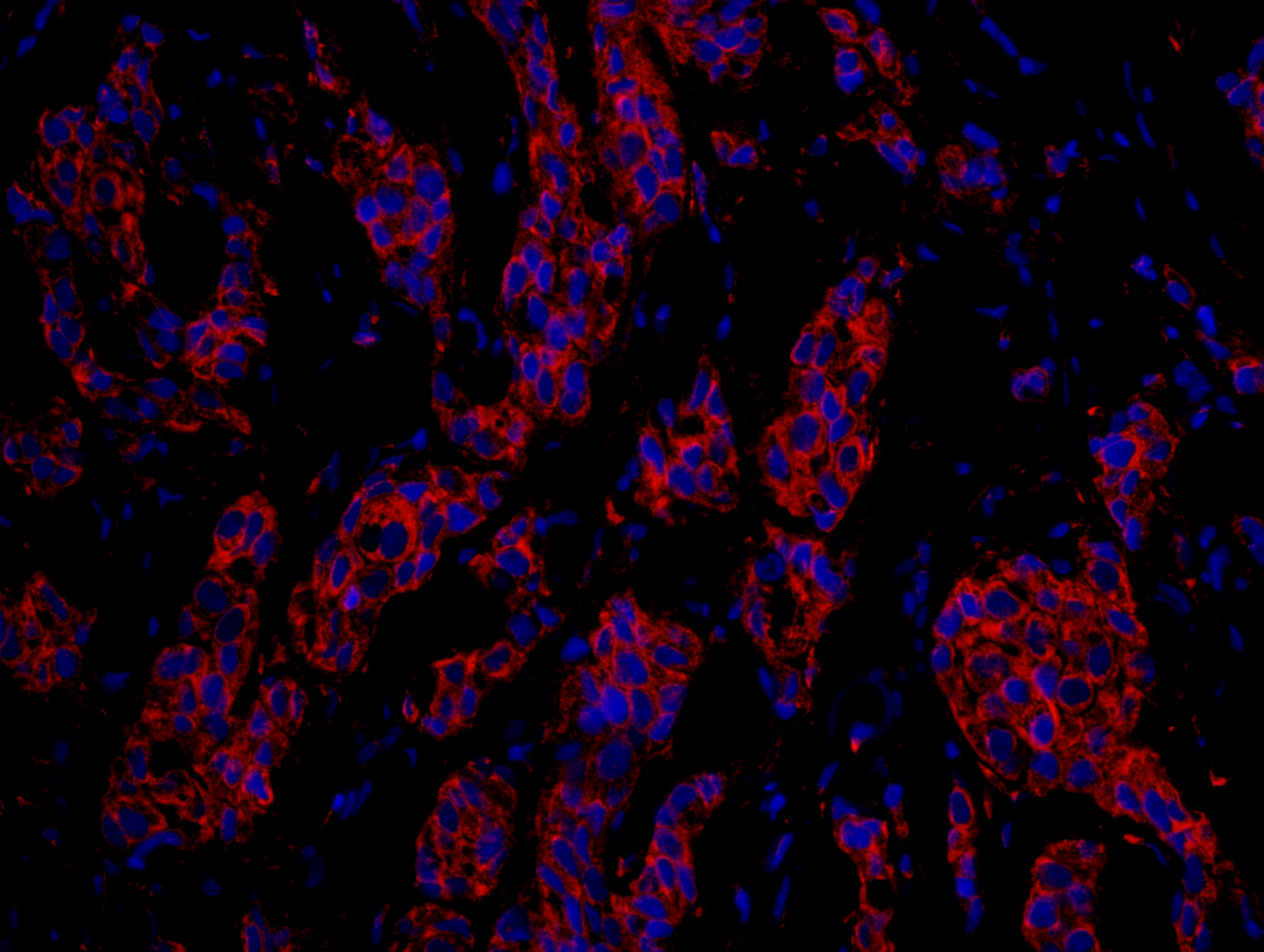Rabbit anti-CKAP4 IHC Antibody