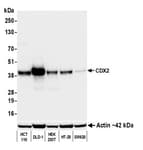 Detection of human CDX2 by western blot.