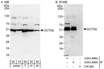 Detection of human and mouse DCTN2 by western blot (h and m) and immunoprecipitation (h).