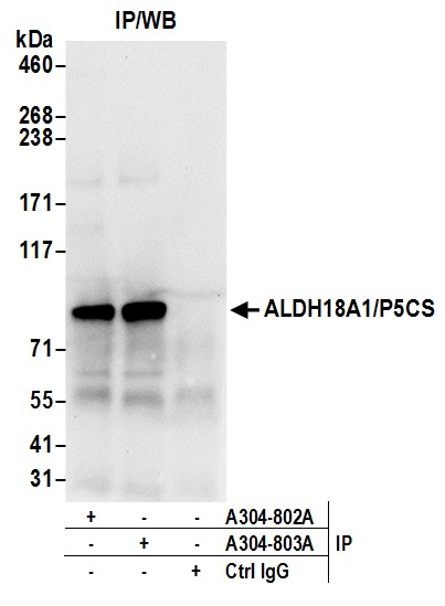 Detection of human ALDH18A1/P5CS by western blot of immunoprecipitates.