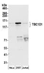 Detection of human TBC1D1 by western blot.