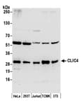 Detection of human and mouse CLIC4 by western blot.