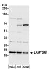 Detection of human LAMTOR1 by western blot.