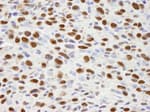 Detection of mouse hnRNP-H by immunohistochemistry.