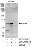 Detection of human PanK4 by western blot of immunoprecipitates.
