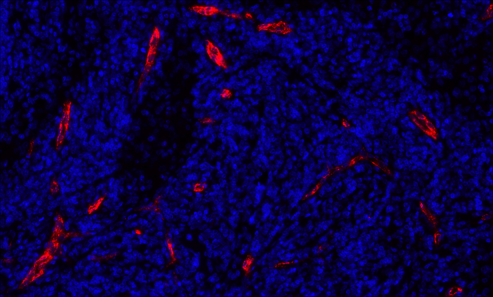 Detection of human P-Selectin/CD62P (red) by immunofluorescence.