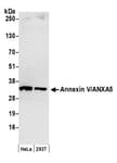Detection of human Annexin V/ANXA5 by western blot.