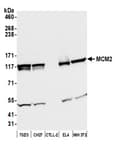 Detection of mouse MCM2 by western blot.