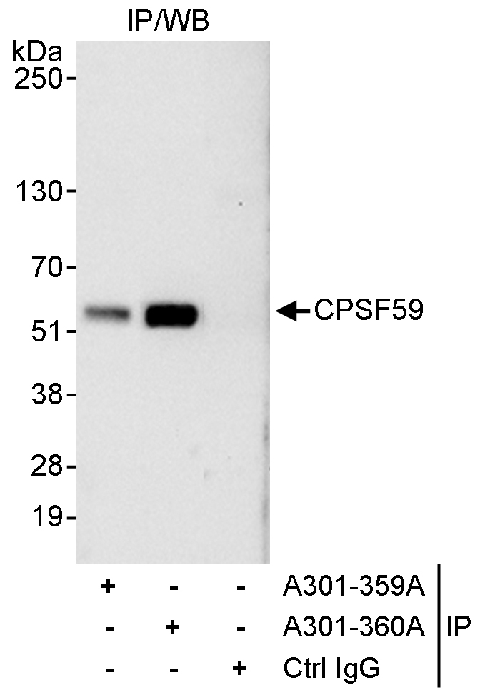 Detection of human CPSF59 by western blot of immunoprecipitates.
