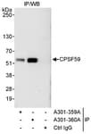 Detection of human CPSF59 by western blot of immunoprecipitates.