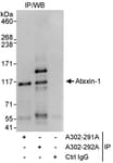 Detection of human Ataxin-1 by western blot of immunoprecipitates.