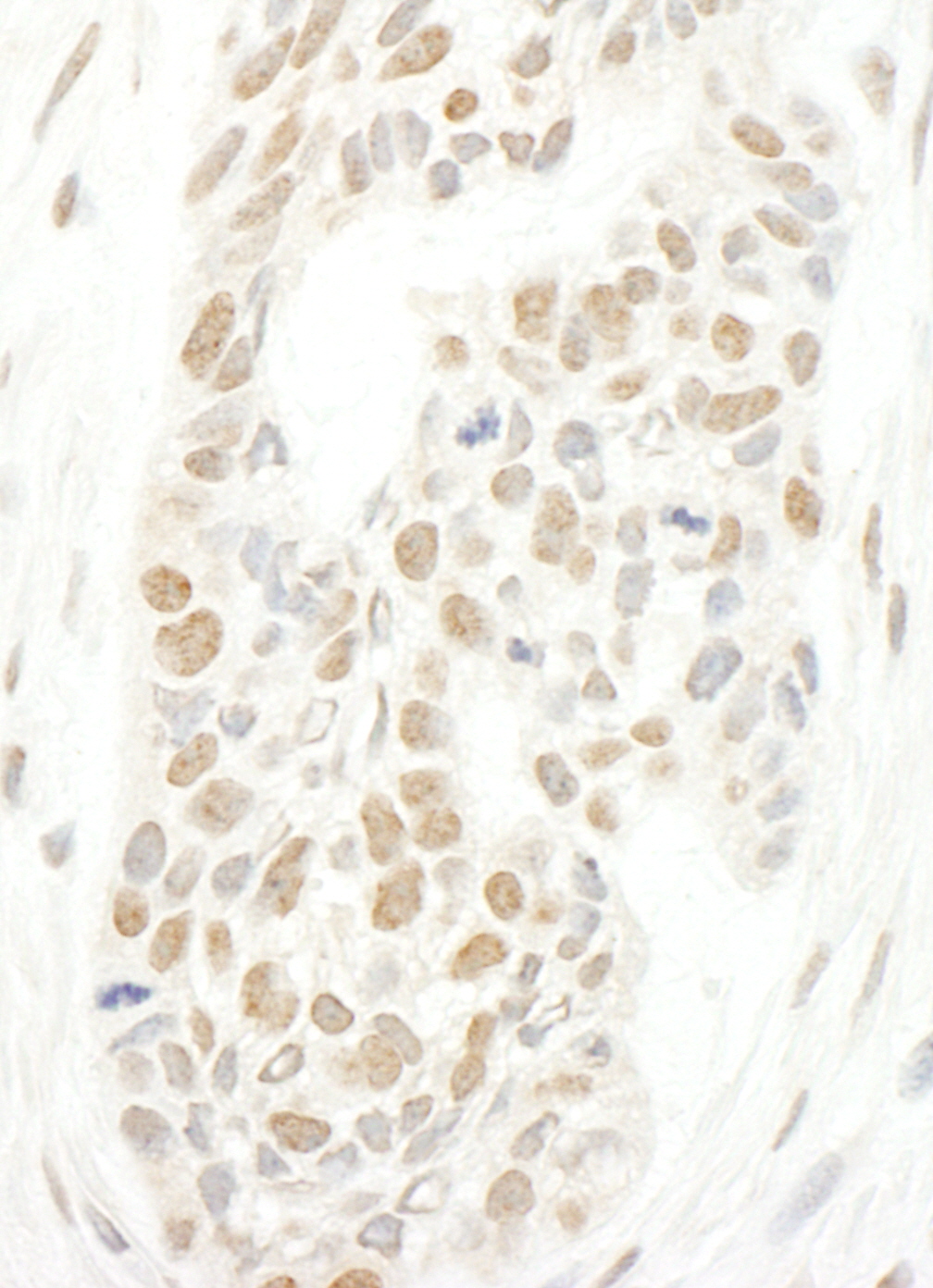 Rabbit anti-CAP-H2 IHC Antibody