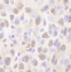 Detection of mouse Rad6 by immunohistochemistry.