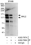 Detection of human MKL2 by western blot of immunoprecipitates.
