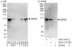 Detection of human and mouse ZBP89 by western blot (h &amp; m) and immunoprecipitation (h).