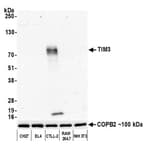 Detection of mouse TIM3 by western blot.