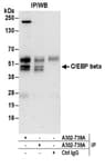 Detection of human C/EBP beta by western blot of immunoprecipitates.