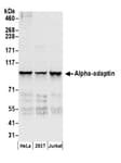 Detection of human Alpha-adaptin by western blot.