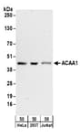 Detection of human ACAA1 by western blot.