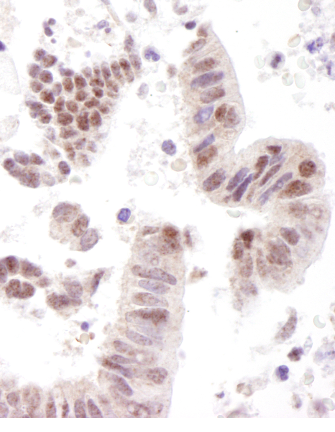 Detection of human CoAA by immunohistochemistry.