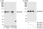 Detection of human DDX24 by western blot and immunoprecipitation.