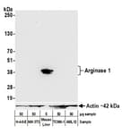Detection of mouse Arginase 1 by western blot.