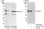 Detection of human and mouse Beclin 1 by western blot (h&amp;m) and immunoprecipitation (h).