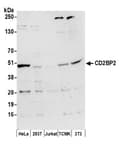 Detection of human and mouse CD2BP2 by western blot.