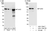 Detection of human FOXK2 by western blot and immunoprecipitation.